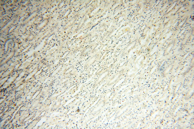 alpha Tubulin Antibody in Immunohistochemistry (Paraffin) (IHC (P))