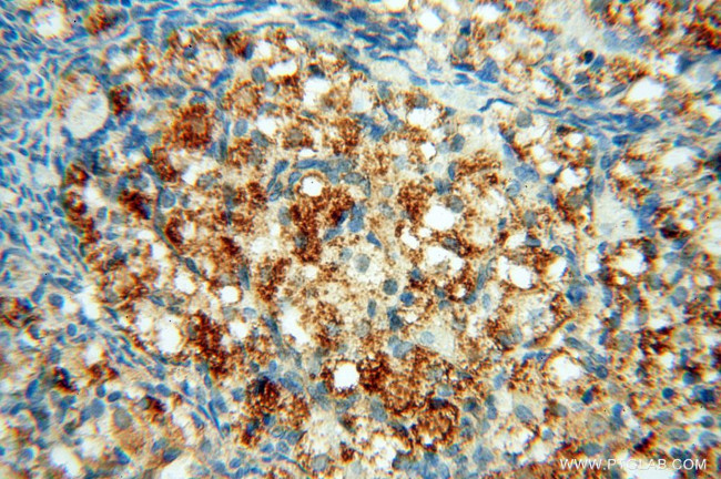 alpha Tubulin Antibody in Immunohistochemistry (Paraffin) (IHC (P))