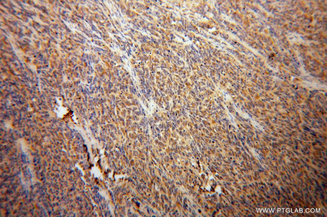 alpha Tubulin Antibody in Immunohistochemistry (Paraffin) (IHC (P))