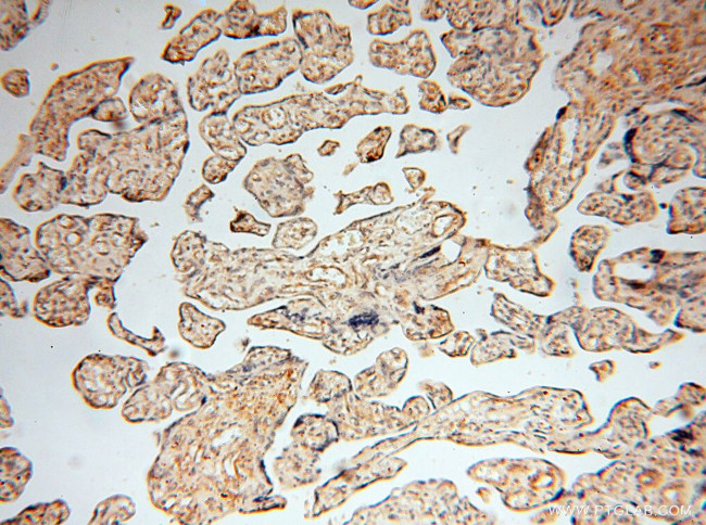 alpha Tubulin Antibody in Immunohistochemistry (Paraffin) (IHC (P))