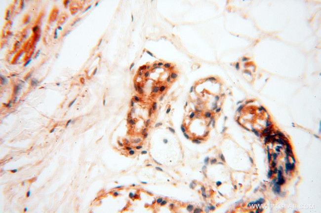 alpha Tubulin Antibody in Immunohistochemistry (Paraffin) (IHC (P))