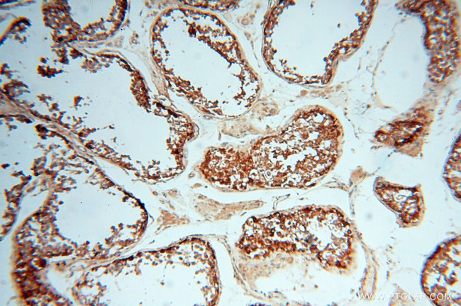 alpha Tubulin Antibody in Immunohistochemistry (Paraffin) (IHC (P))