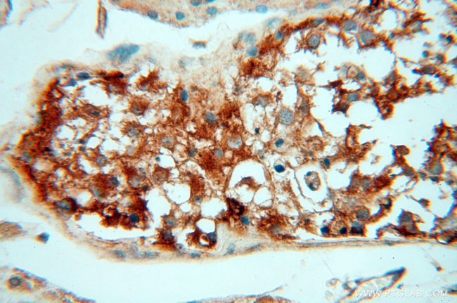 alpha Tubulin Antibody in Immunohistochemistry (Paraffin) (IHC (P))