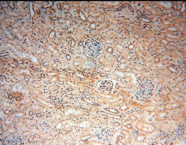 RBAP48 Antibody in Immunohistochemistry (Paraffin) (IHC (P))