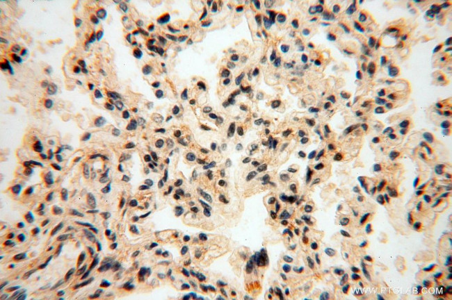 RBAP48 Antibody in Immunohistochemistry (Paraffin) (IHC (P))