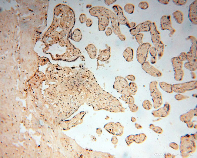 RBAP48 Antibody in Immunohistochemistry (Paraffin) (IHC (P))