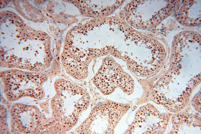 RBAP48 Antibody in Immunohistochemistry (Paraffin) (IHC (P))