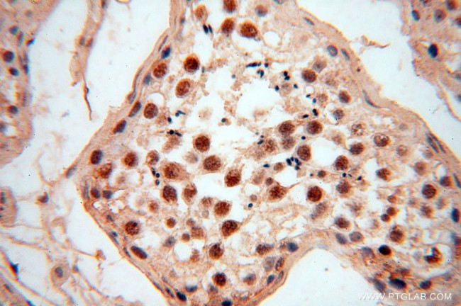 RBAP48 Antibody in Immunohistochemistry (Paraffin) (IHC (P))