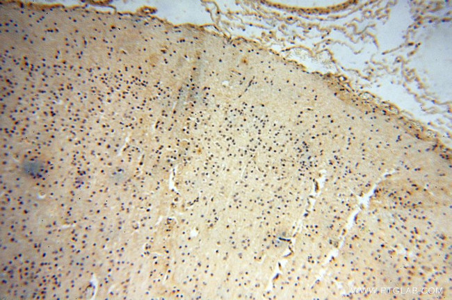 RBAP48 Antibody in Immunohistochemistry (Paraffin) (IHC (P))