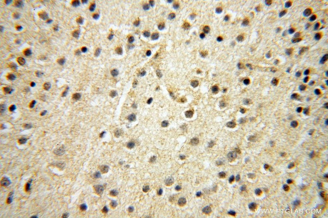 RBAP48 Antibody in Immunohistochemistry (Paraffin) (IHC (P))