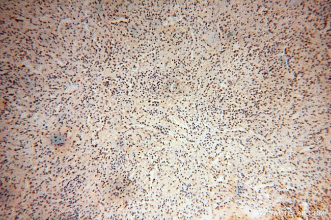 RBAP48 Antibody in Immunohistochemistry (Paraffin) (IHC (P))