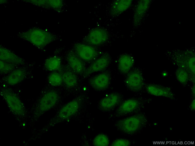 RBAP48 Antibody in Immunocytochemistry (ICC/IF)