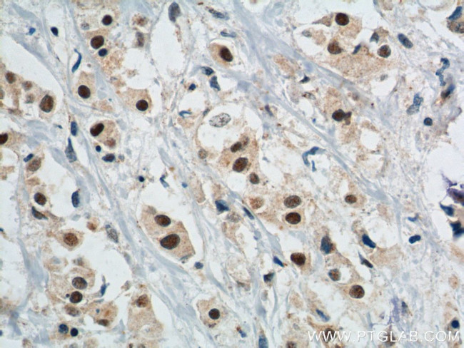 APOBEC3B Antibody in Immunohistochemistry (Paraffin) (IHC (P))