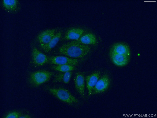 DHRS9 Antibody in Immunocytochemistry (ICC/IF)