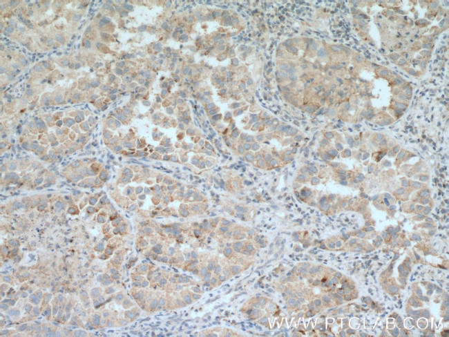 DHRS9 Antibody in Immunohistochemistry (Paraffin) (IHC (P))