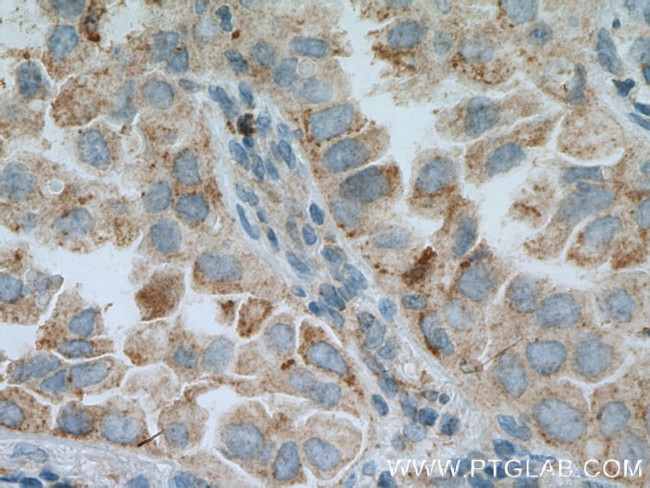 DHRS9 Antibody in Immunohistochemistry (Paraffin) (IHC (P))