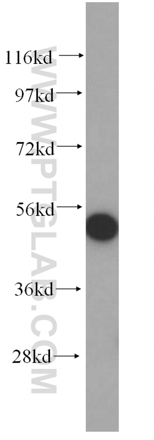 DHRS9 Antibody in Western Blot (WB)