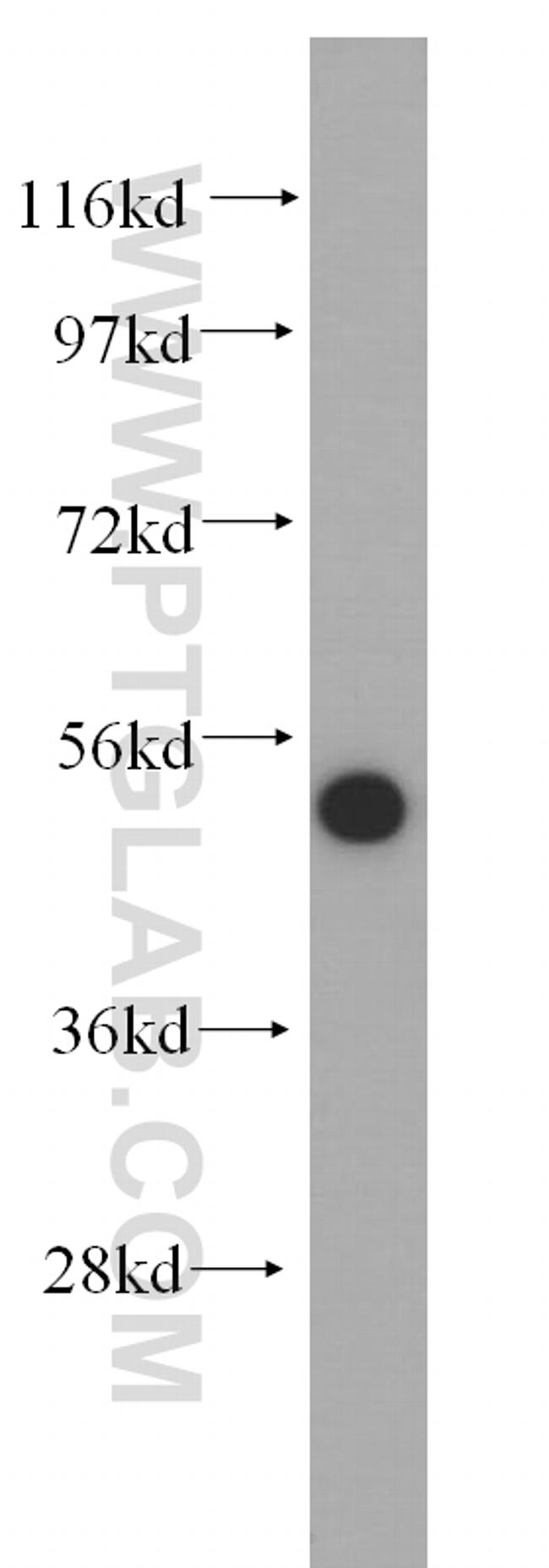 DHRS9 Antibody in Western Blot (WB)