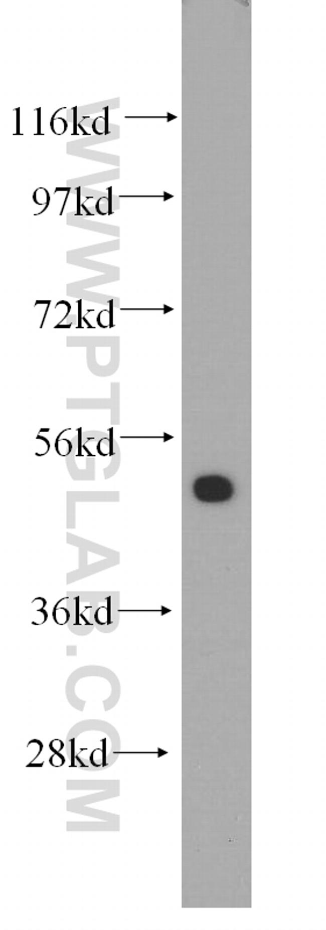 DHRS9 Antibody in Western Blot (WB)