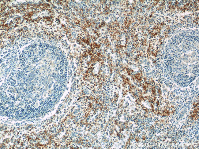 GP9 Antibody in Immunohistochemistry (Paraffin) (IHC (P))