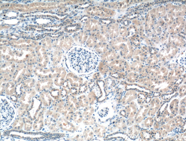 BBS5 Antibody in Immunohistochemistry (Paraffin) (IHC (P))