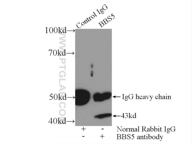 BBS5 Antibody in Immunoprecipitation (IP)