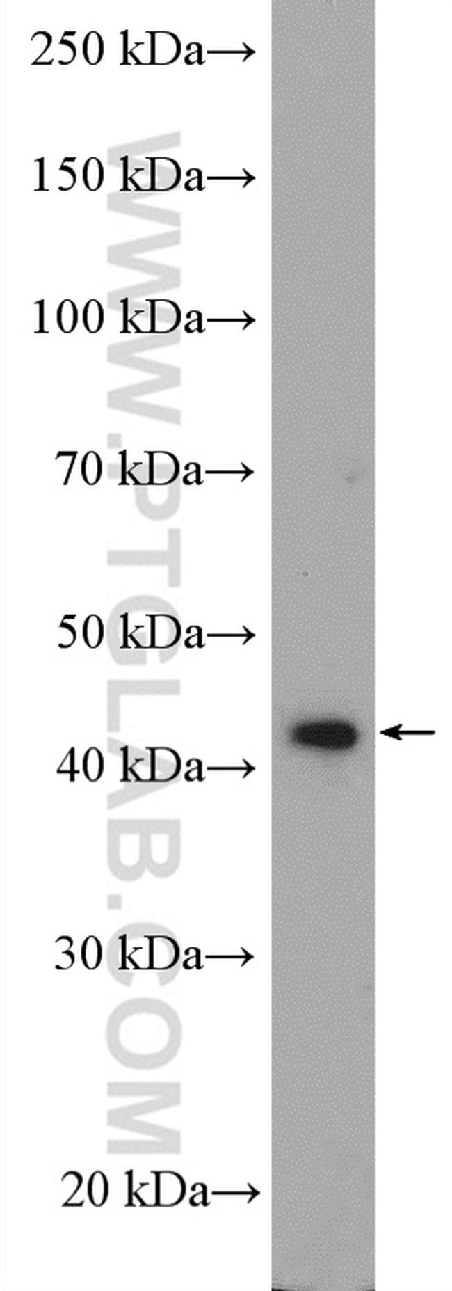 BBS5 Antibody in Western Blot (WB)