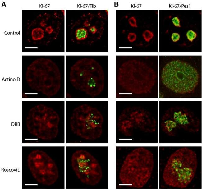 Ki-67 Antibody in Immunocytochemistry (ICC/IF)