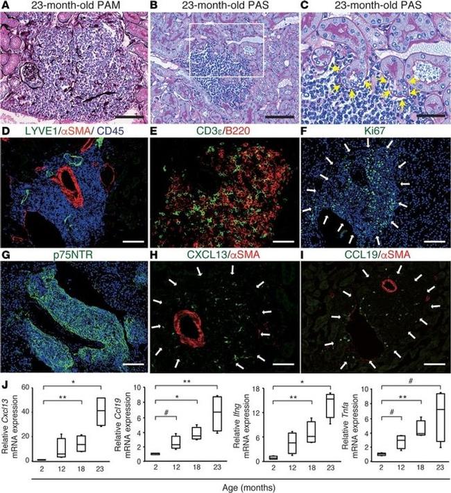 CD45 Antibody in Immunohistochemistry (Paraffin) (IHC (P))