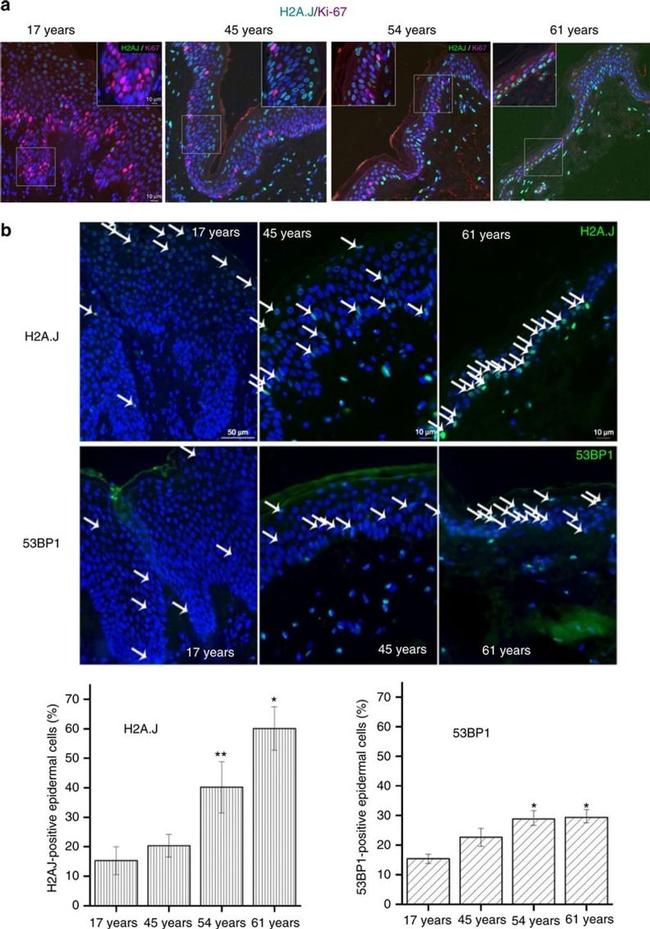 Ki-67 Antibody in Immunohistochemistry (Paraffin) (IHC (P))