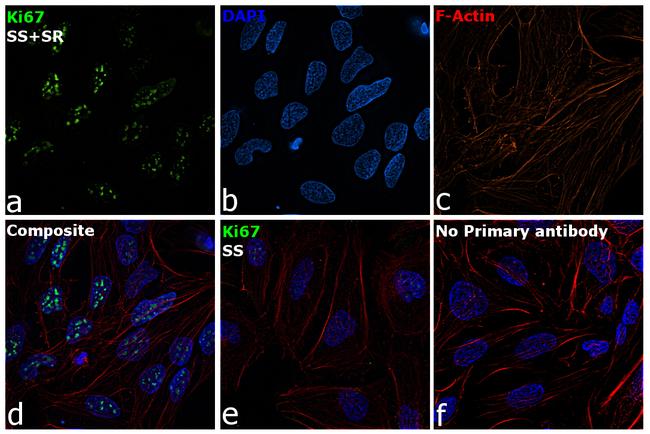 Ki-67 Antibody