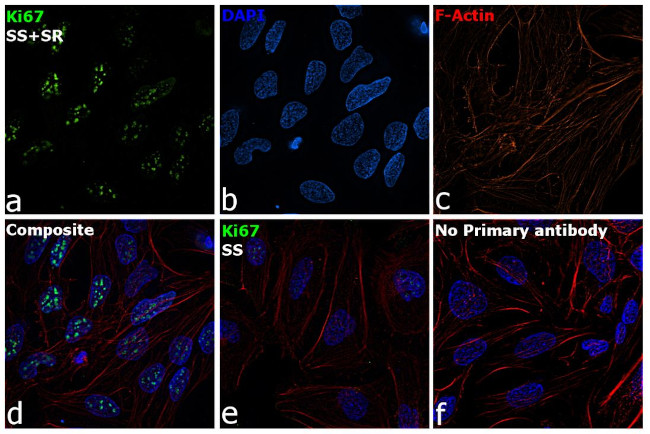 Ki-67 Antibody in Immunocytochemistry (ICC/IF)