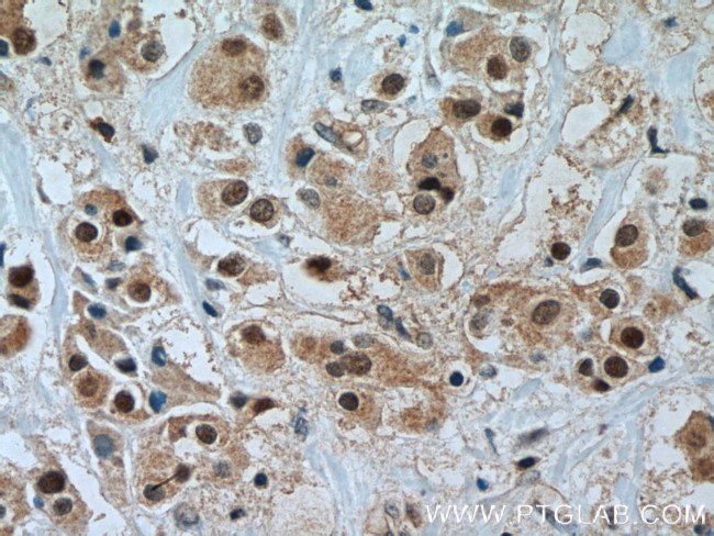 TFAP2C Antibody in Immunohistochemistry (Paraffin) (IHC (P))