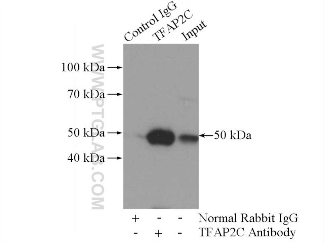 TFAP2C Antibody in Immunoprecipitation (IP)