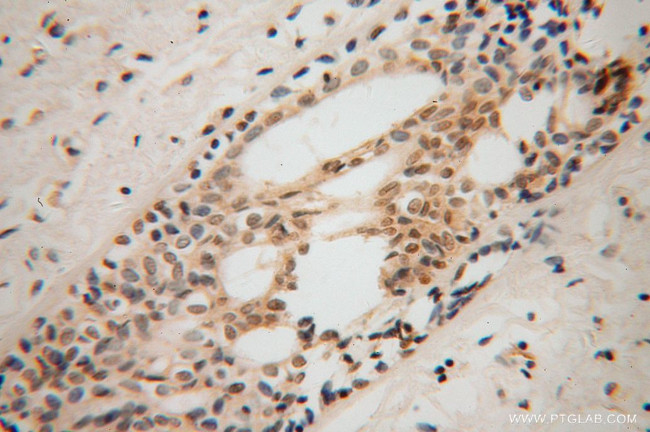 TFAP2C Antibody in Immunohistochemistry (Paraffin) (IHC (P))