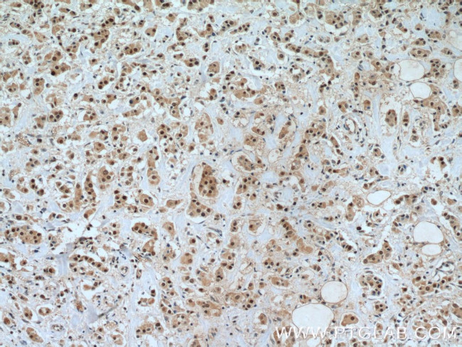 TFAP2C Antibody in Immunohistochemistry (Paraffin) (IHC (P))