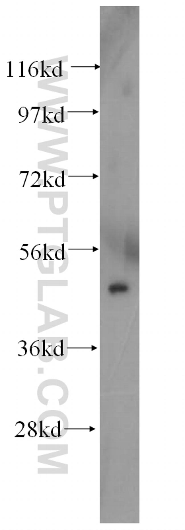 TFAP2C Antibody in Western Blot (WB)