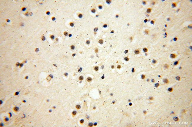 DEDD2 Antibody in Immunohistochemistry (Paraffin) (IHC (P))