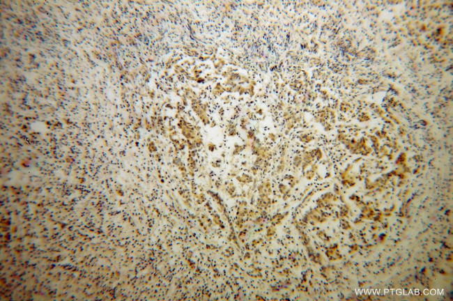 SDHC Antibody in Immunohistochemistry (Paraffin) (IHC (P))