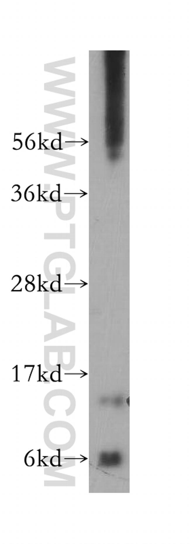 SDHC Antibody in Western Blot (WB)