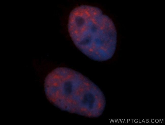 SF3B3 Antibody in Immunocytochemistry (ICC/IF)