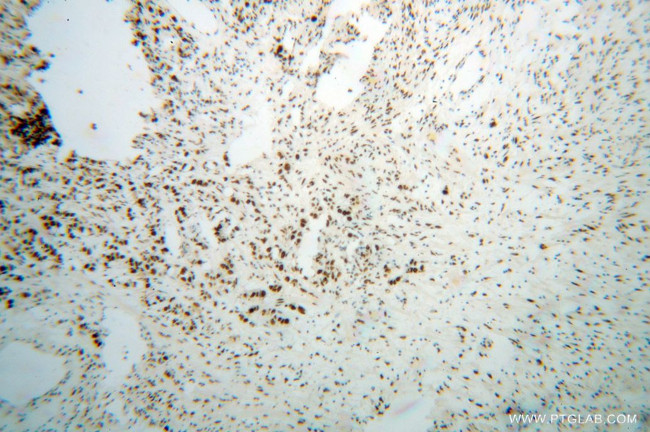 SF3B3 Antibody in Immunohistochemistry (Paraffin) (IHC (P))