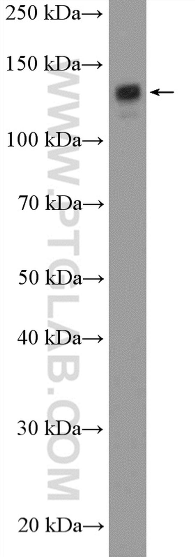 SF3B3 Antibody in Western Blot (WB)