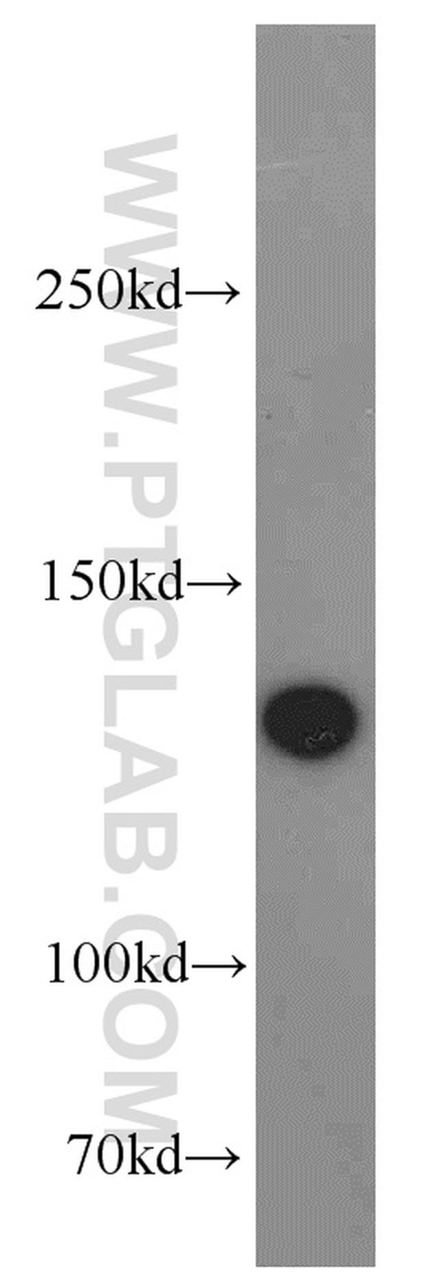 SF3B3 Antibody in Western Blot (WB)