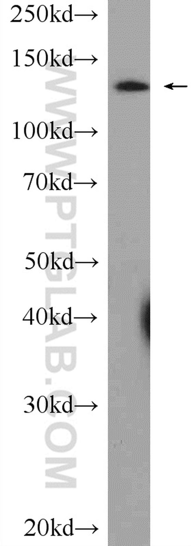 SF3B3 Antibody in Western Blot (WB)