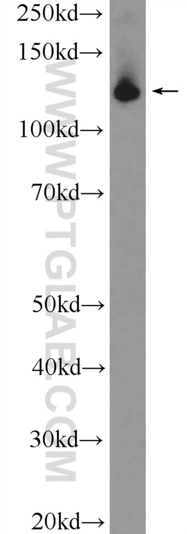 SF3B3 Antibody in Western Blot (WB)