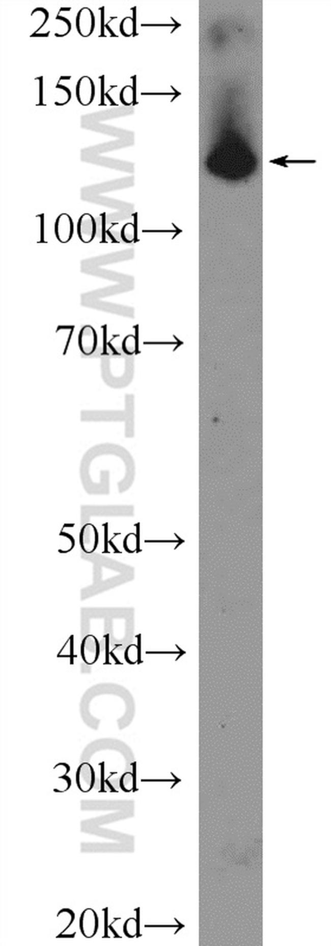 SF3B3 Antibody in Western Blot (WB)