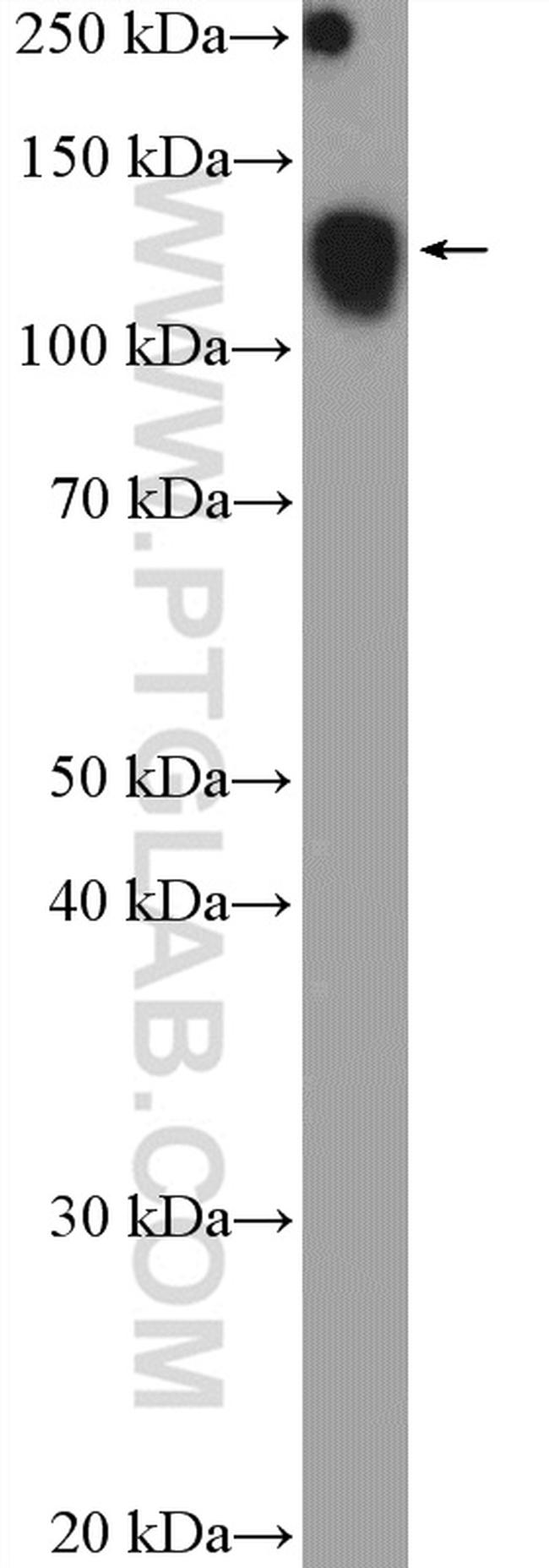 SF3B3 Antibody in Western Blot (WB)