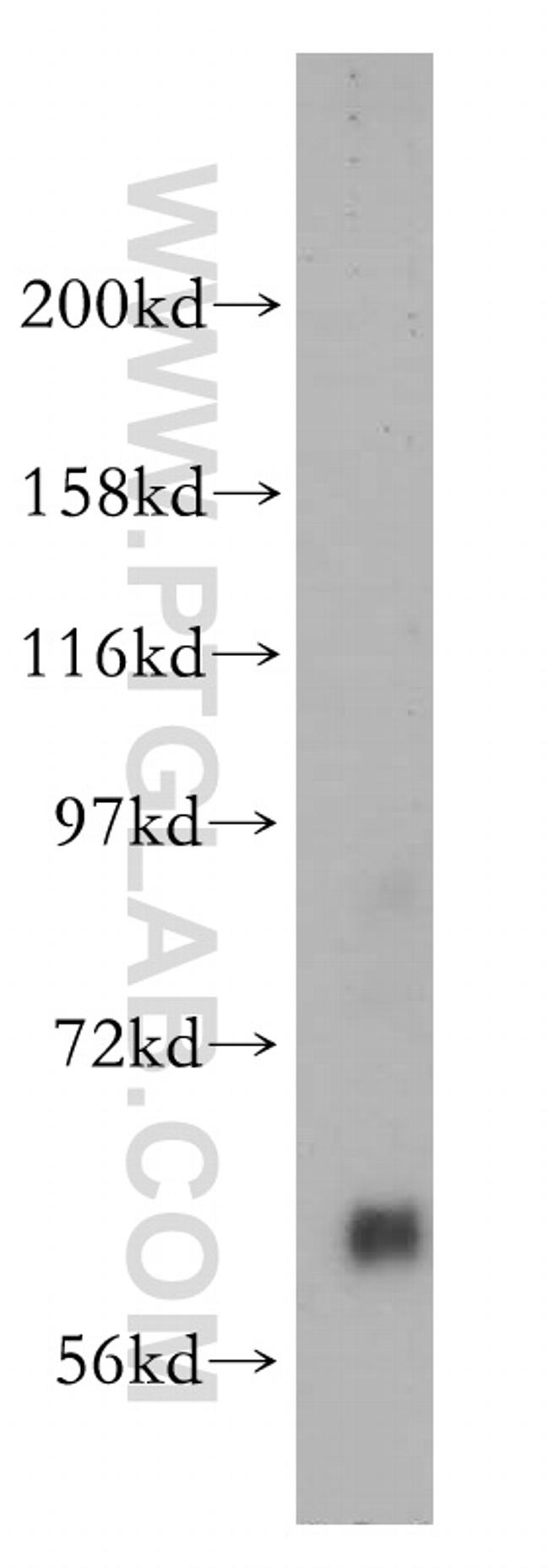 Pikachurin Antibody in Western Blot (WB)