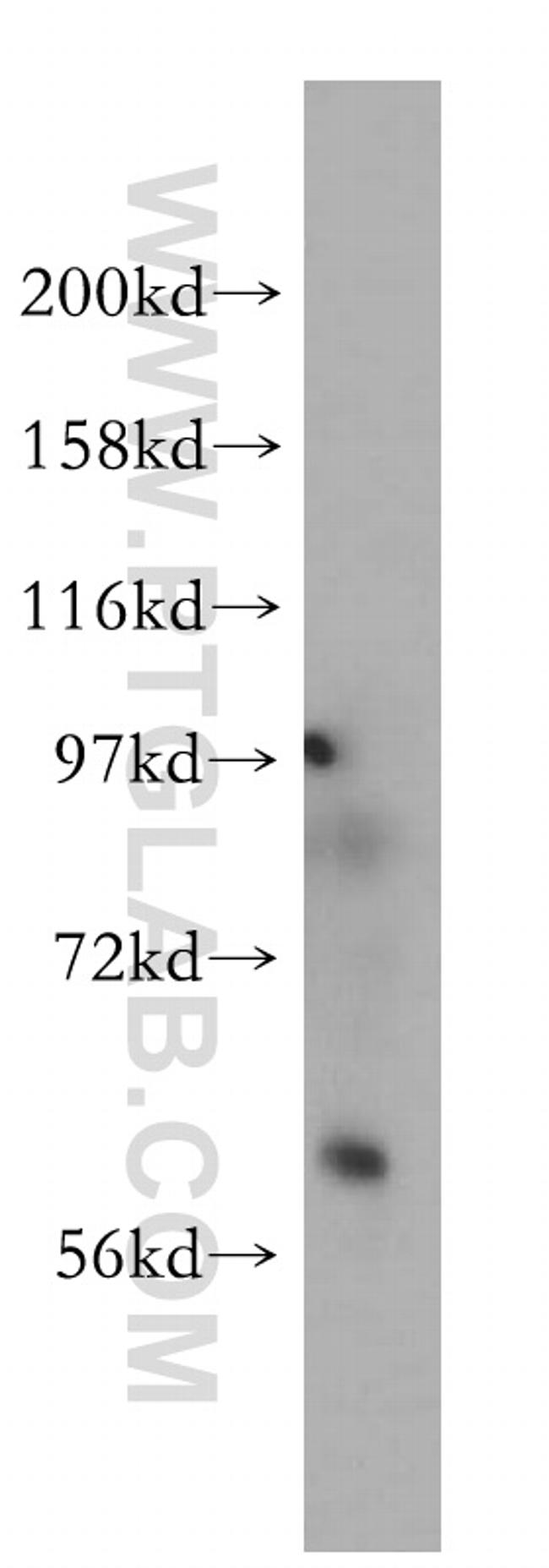 Pikachurin Antibody in Western Blot (WB)